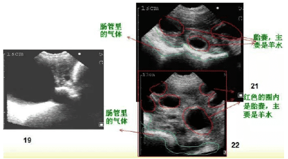 母猪怀孕妊娠25天前B超图像