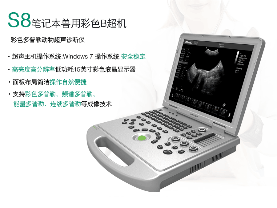 笔记本牛用b超机