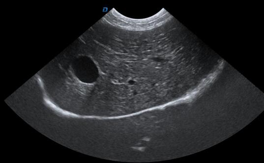 犬肝胆b超图像