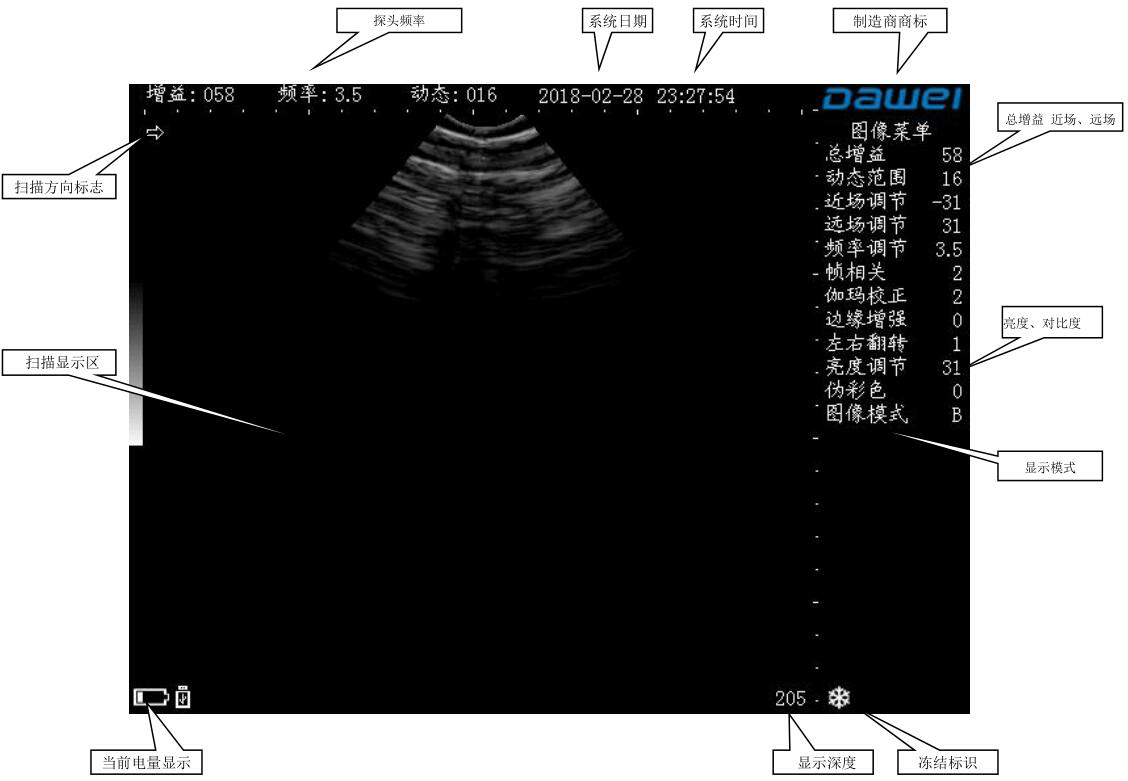 掌上兽用B超机成像显示