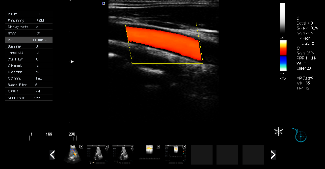 动物彩超机P5-VET图像