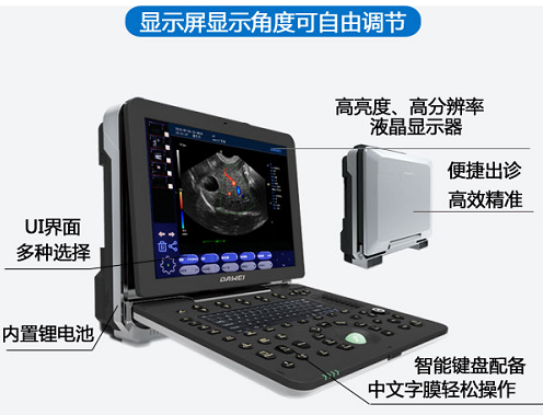 便携式兽用b超机组成