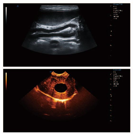 高清双屏实验用彩超机成像图