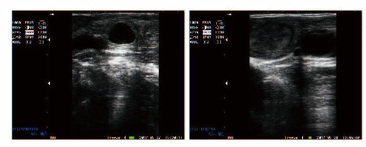 掌上兽用b超机S10成像图